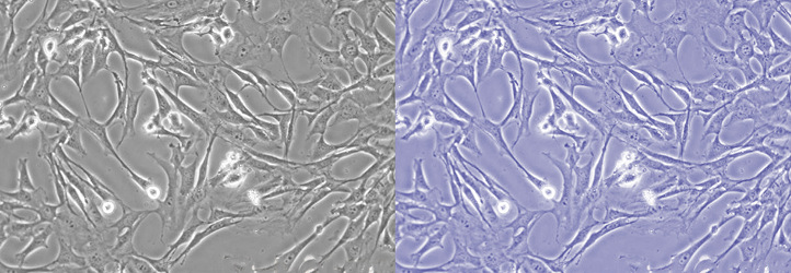 Leica DM IL LED倒置熒光顯微鏡細(xì)胞圖像色溫調(diào)整效果對(duì)比.jpg